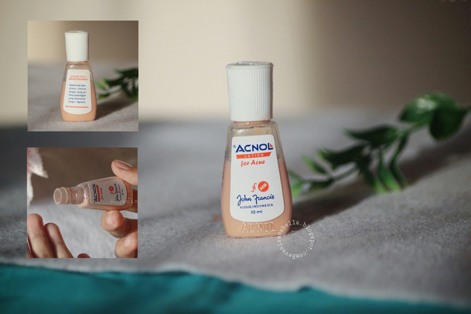 Pengalaman Menggunakan Acnol Lotion Dan Acnol Gel For Acne Dengan