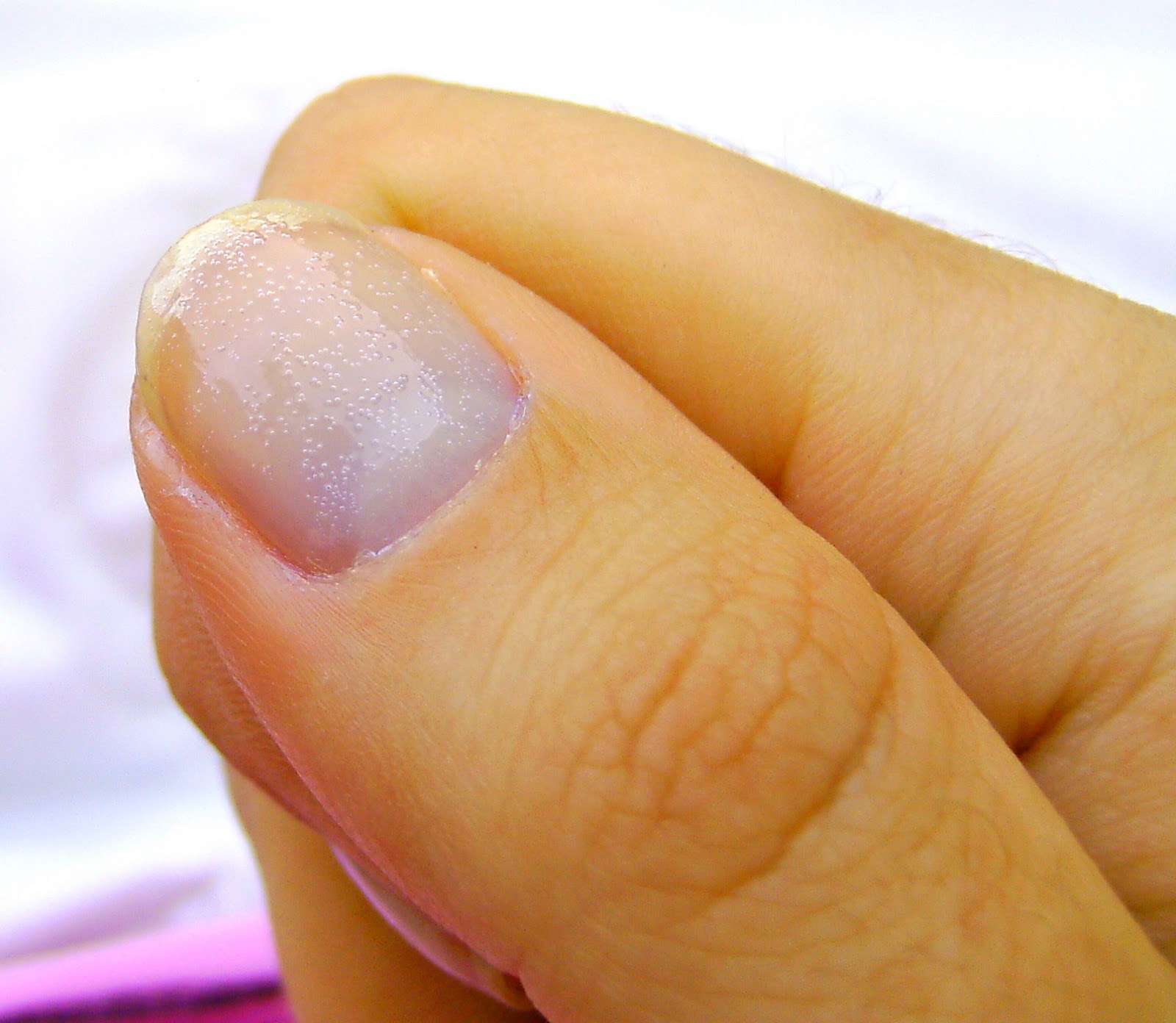 Question : Puis-je utiliser du dissolvant pour vernis à ongles sur de la résine ?