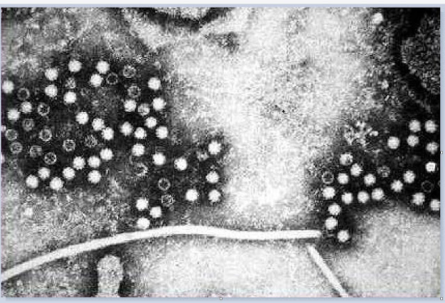 Penampakan virus hepatitis E di bawah mikroskop pembesaran, hostologis, praktikum, kedokteran, mikrobiologi, HEV, jas lab, laboratorium