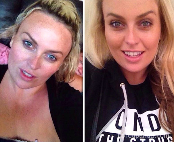 10+ Before-And-After Pics Show What Happens When You Stop Drinking - 1 Year Sober