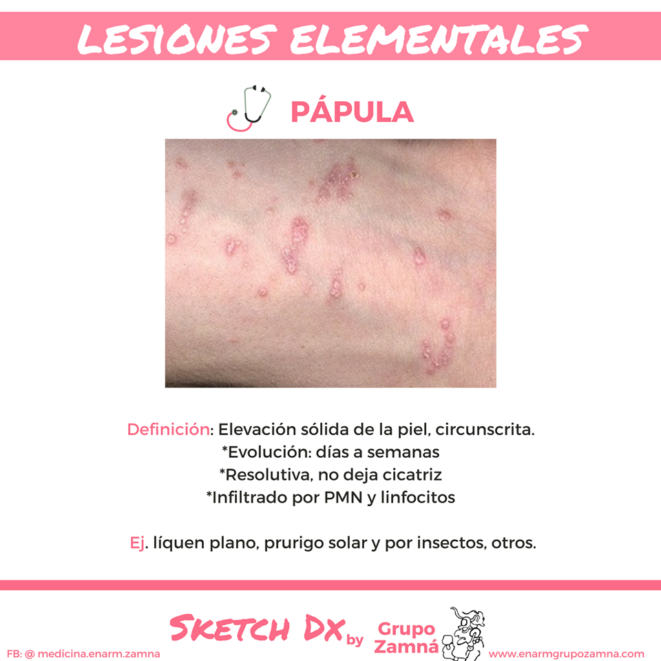 papula papula