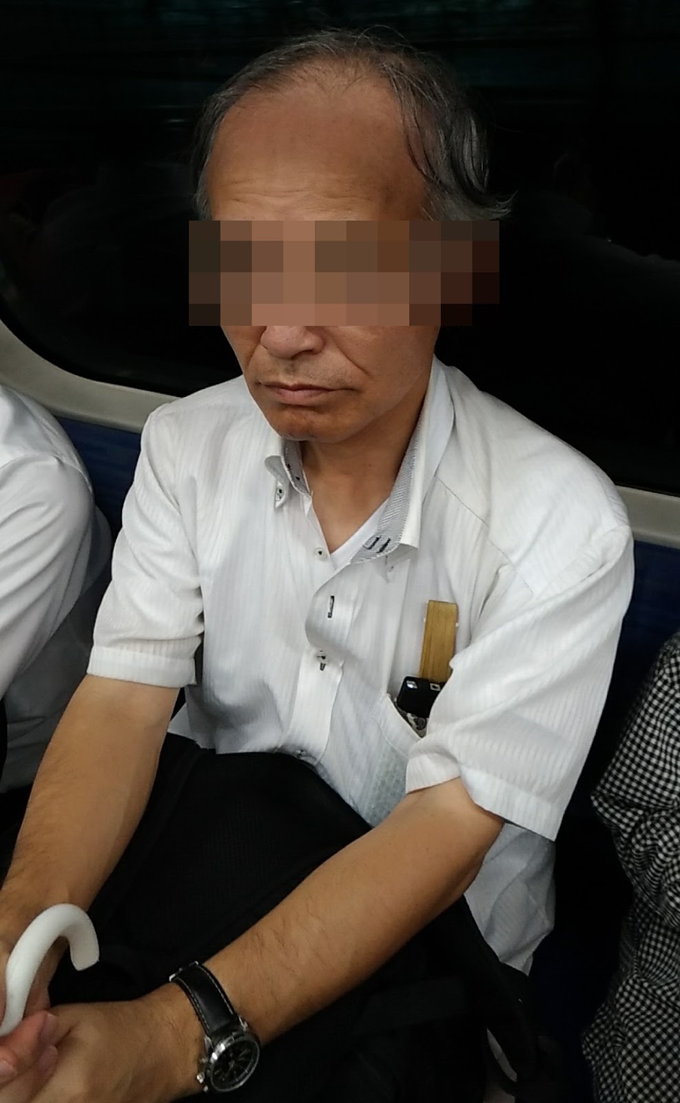  SUSを介した掻爬はありますか?
