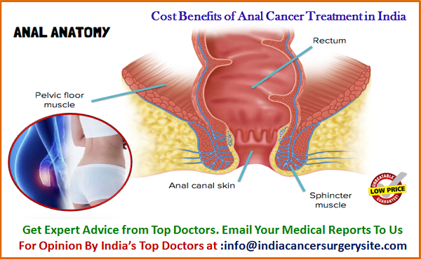 Anal cancer information — img 15