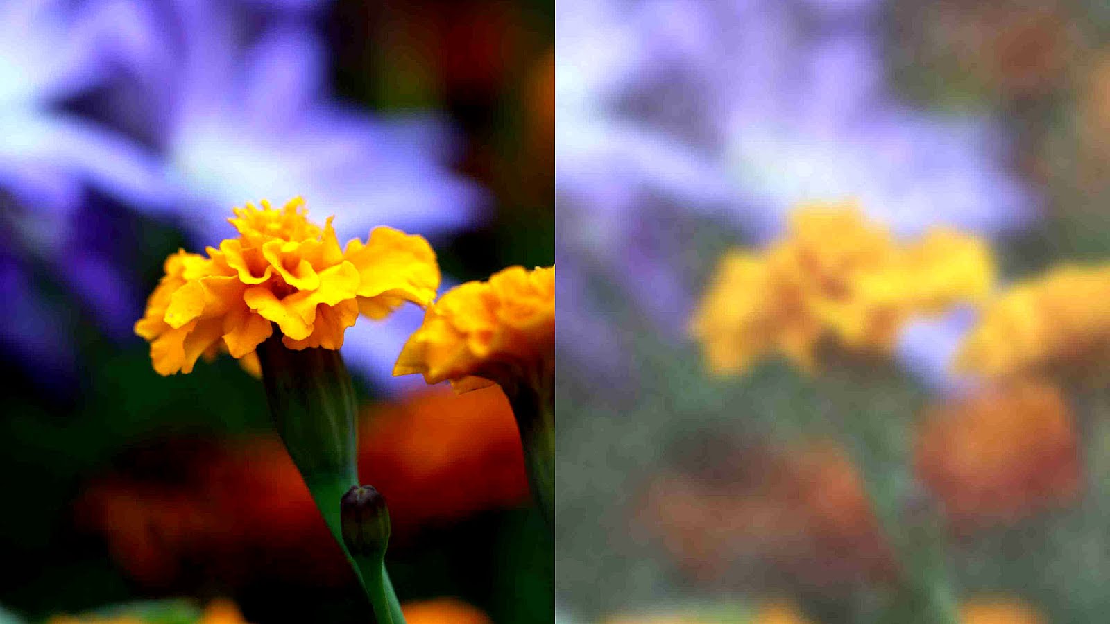 Foggy Vision After Cataract Surgery Vision Choices