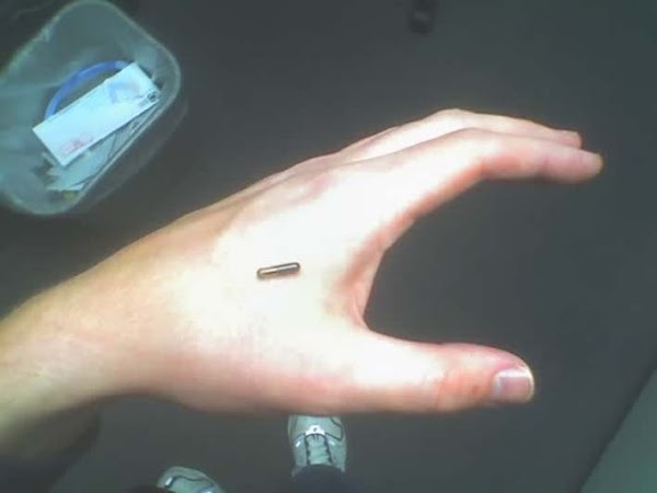 Más De 3,000 Alemanes Llevan Implantado Un Microchip En La mano . Más De 3,000 Alemanes Llevan Implantado Un Microchip En La mano .