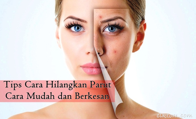 Ubat Untuk Menghilangkan Parut Hitam Berubat k