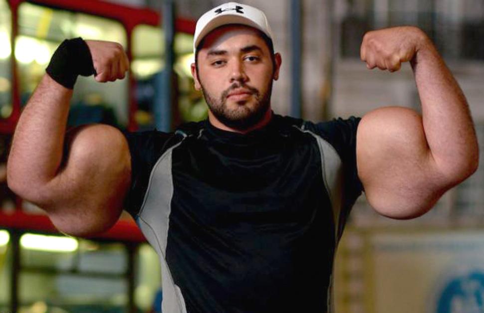 SYNTHOL là gì? Bơm dầu vào cơ bắp gây hậu quả gì