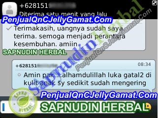 Cara Mengobati Ruam Popok Secara Alami dan Cepat Cara Mengobati Ruam Popok Secara Alami dan Cepat