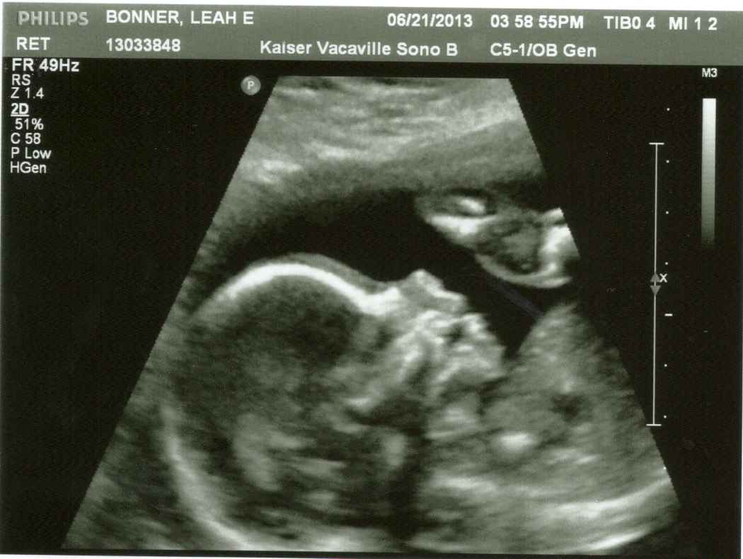 30 weeks 4d ultrasound pictures 30 weeks 4d ultrasound pictures