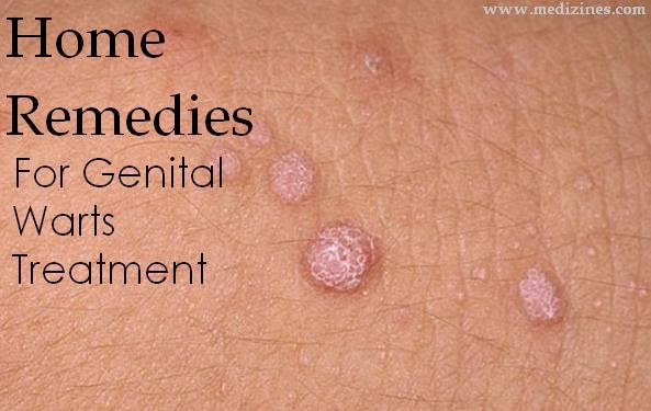 Genital warts: MedlinePlus Medical Encyclopedia