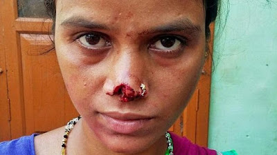 هندي يقطع أنف زوجته ويهرب به لسبب غريب!