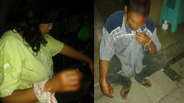 Pergoki Istri Tidur Tanpa Sehelai Kain Bersama Selingkuhan, Suami Tikam Kepala Selingkuhan Pergoki Istri Tidur Tanpa Sehelai Kain Bersama Selingkuhan, Suami Tikam Kepala Selingkuhan