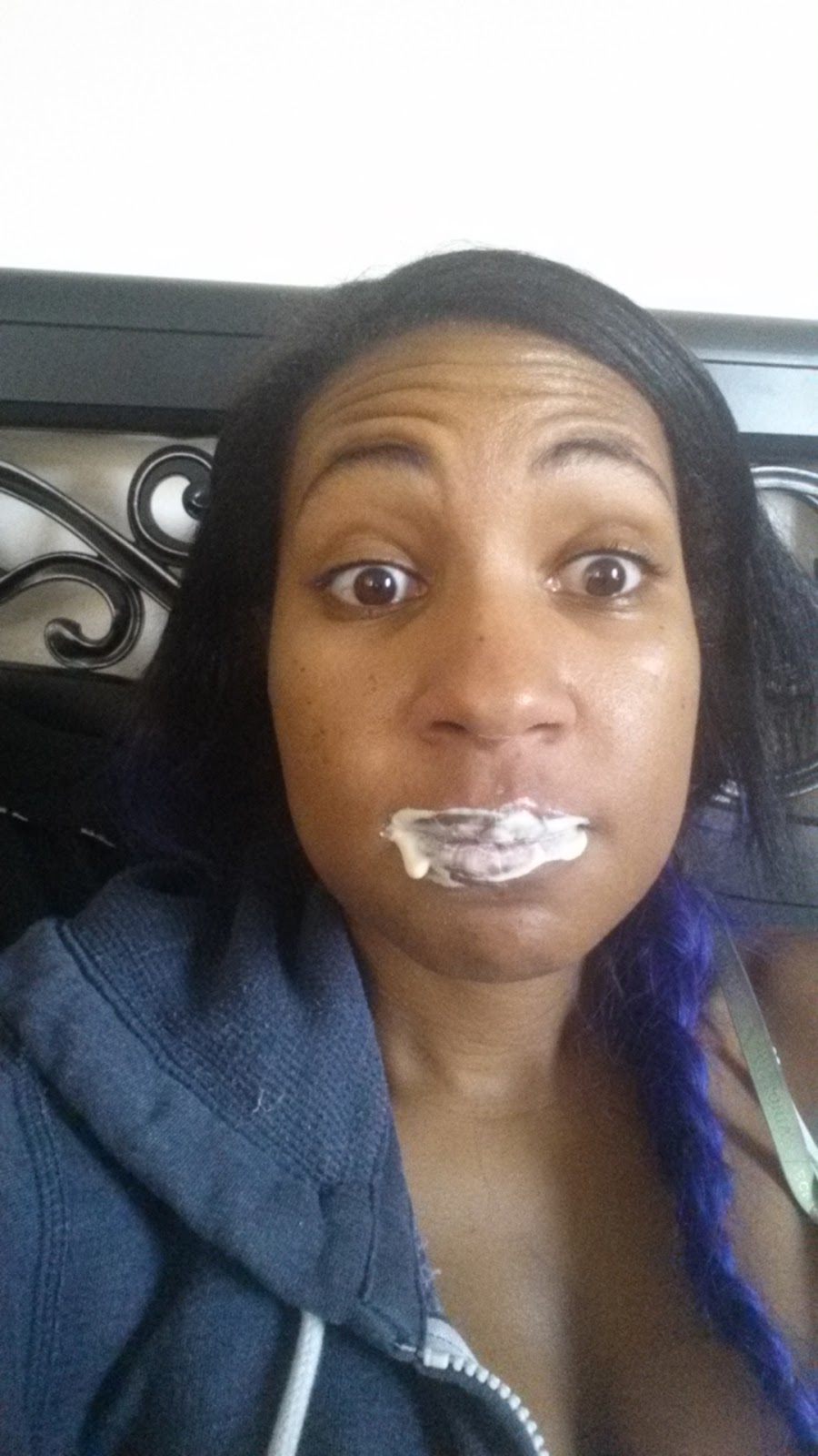 Through the Wire Journey With My Jaw Wired Shut and After Jaw Surgery