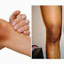 3 Tips for smooth skin on the elbows and knees - Naturally