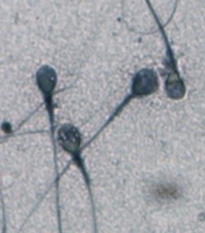 Imagen de microscopía de espermatozoides