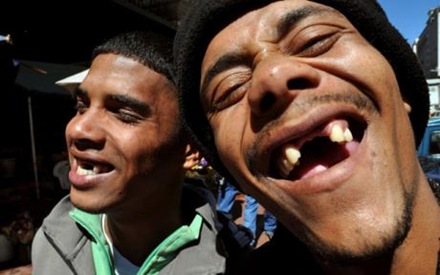 Fotos De Pessoas Banguelas