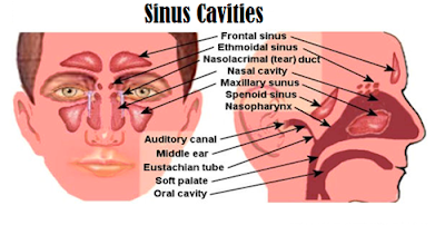 Sinusitis Natural and Traditional Medicine Quickly