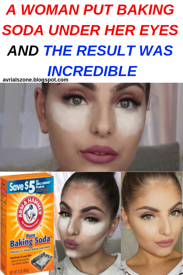 Healthy Beauty and Diet A WOMAN PUT BAKING SODA UNDER HER EYES AND THE