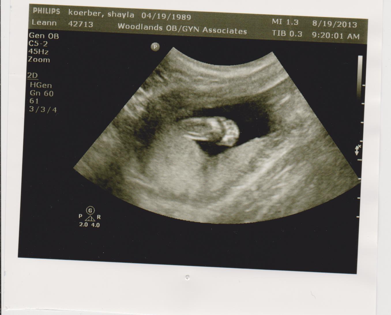 Gamer Mama 21 weeks &amp; 20 week ultrasound