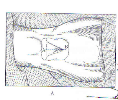 Teknik Operasi Laringotomy pada Hewan (Bedah Thoraks)