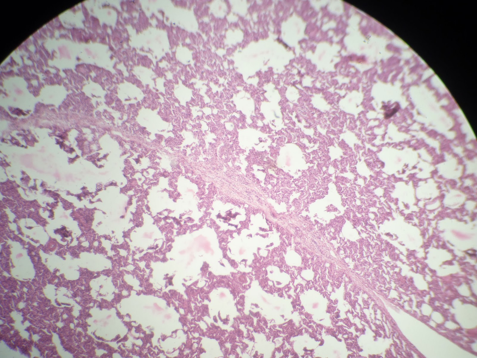 Ula Medicina 2012: HIstologia Pulmon