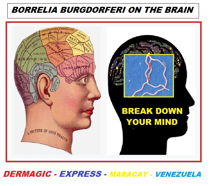 ENFERMEDAD DE LYME Y DEMENCIA, ALZHEIMER, PARKINSON, AUTISMO, UNA