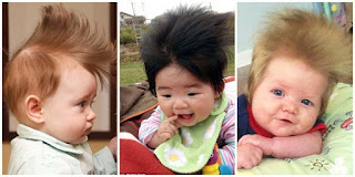 Bayi Unik Berikut Memiliki Rambut Yang Lebat Layaknya Orang Dewasa