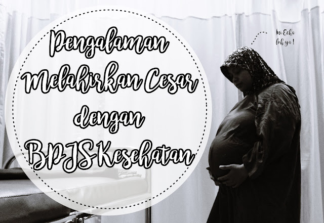 Ibu Echa melahirkan cesar pakai BPJS kesehatan