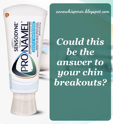 Sensodyne Pronamel possible solution to stubborn breakouts around the chin and mouth.