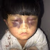 Heartbreaking images of 4-year-old girl beaten by her father, chained to the toilet, and made to wash his clothes 