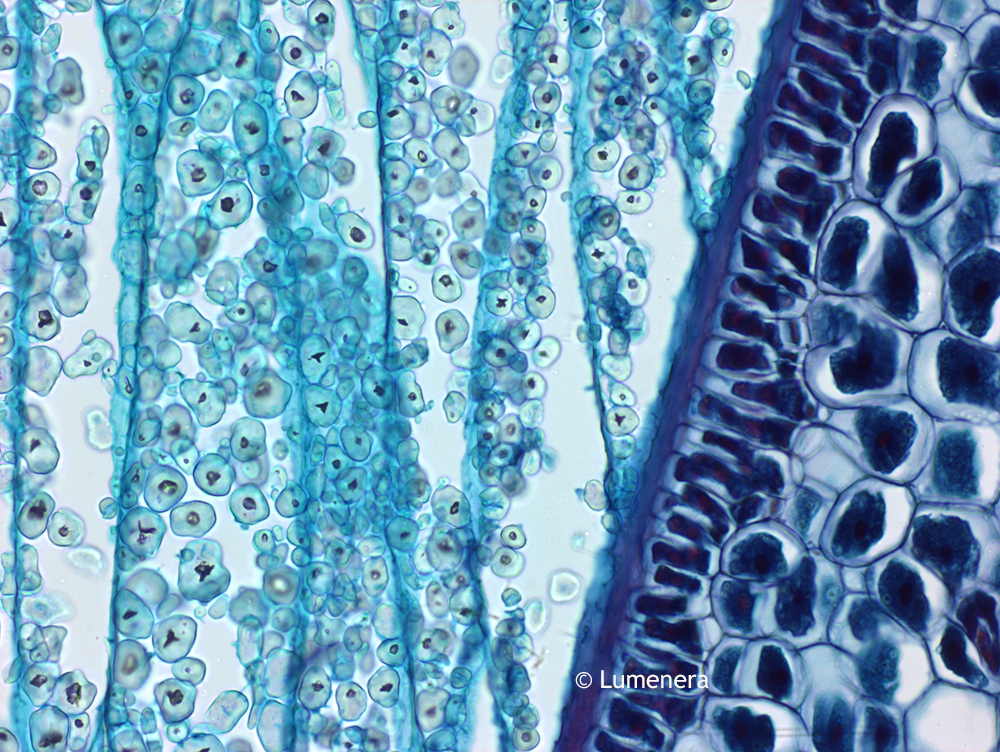 Microscope World Blog Corn Grain Under the Microscope