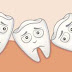 Răng khôn là răng gì vậy mọi người?
