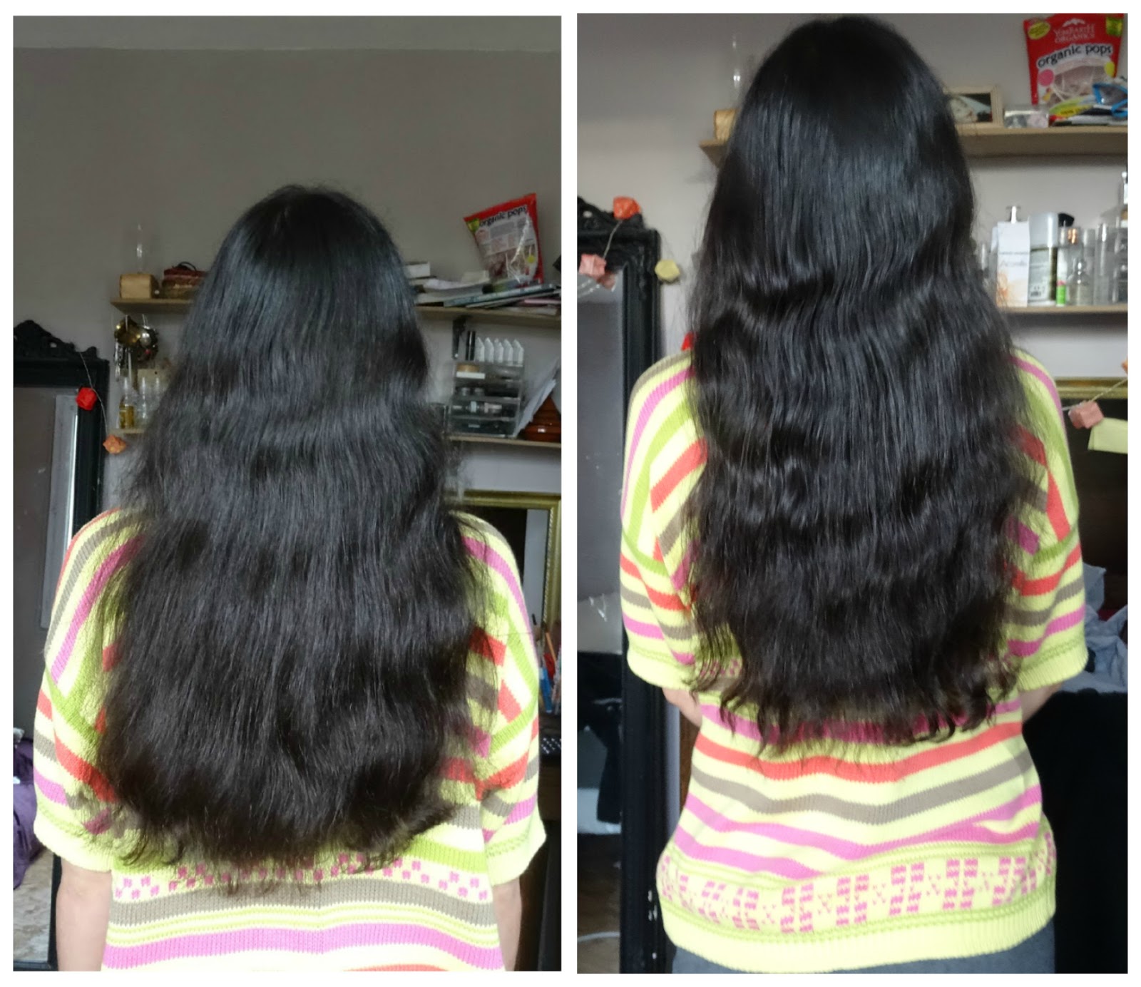 L Alopecie Chute De Cheveux Post Partum Minimiser Les Degats