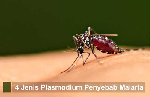 4 Jenis Plasmodium Penyebab Penyakit Malaria, Gejala, Cara Penularan, Pengobatan dan Pencegahannya