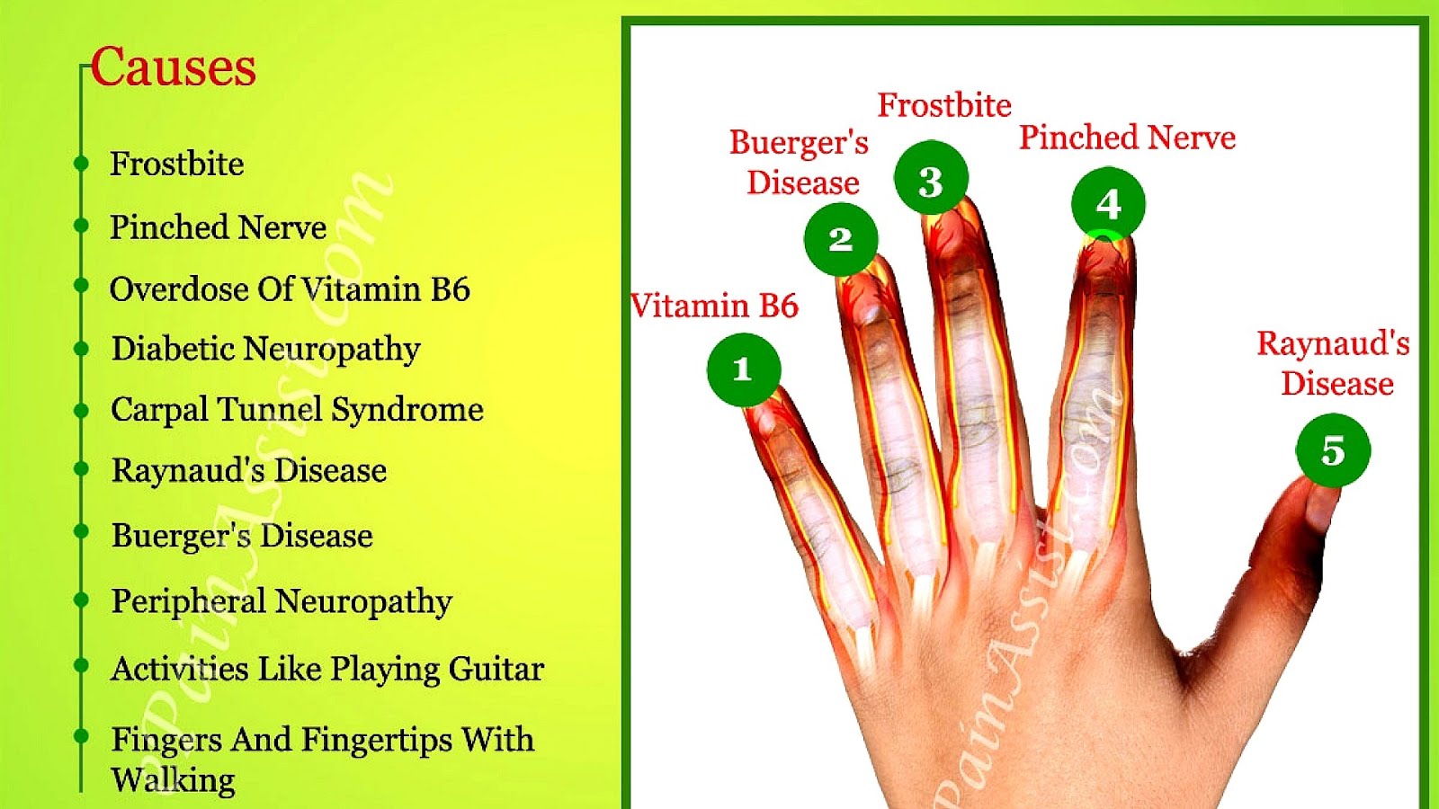 Numb Index Finger Left Hand - Index Choices