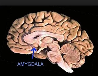 Amygdala The tumor is malignant