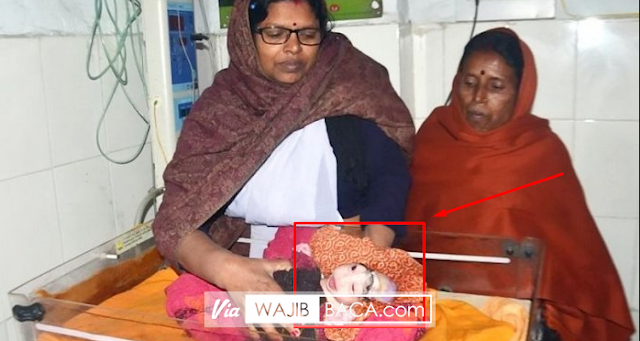 NGERI! Ibu Ini Tolak Beri ASI dan Menganggap Bayinya Dikutuk. Lha Bayinya Seperti Ini... NGERI! Ibu Ini Tolak Beri ASI dan Menganggap Bayinya Dikutuk. Lha Bayinya Seperti Ini...