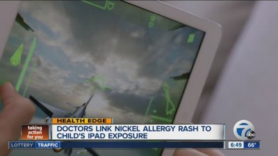 Astaga! Alergi Terhadap iPad Bisa Timbulkan Ruam di Kulit