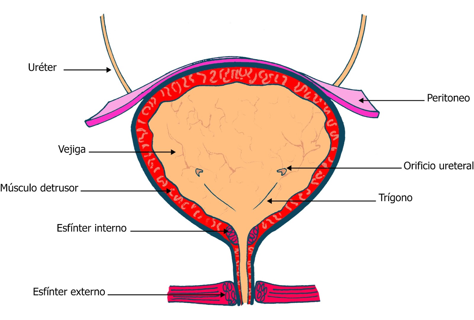 urodyblog Disinergia detrusor vesicoesfinteriana (DVE) urodyblog Disinergia detrusor vesicoesfinteriana (DVE)