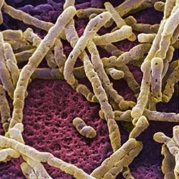 enfermedades causadas por bacterias