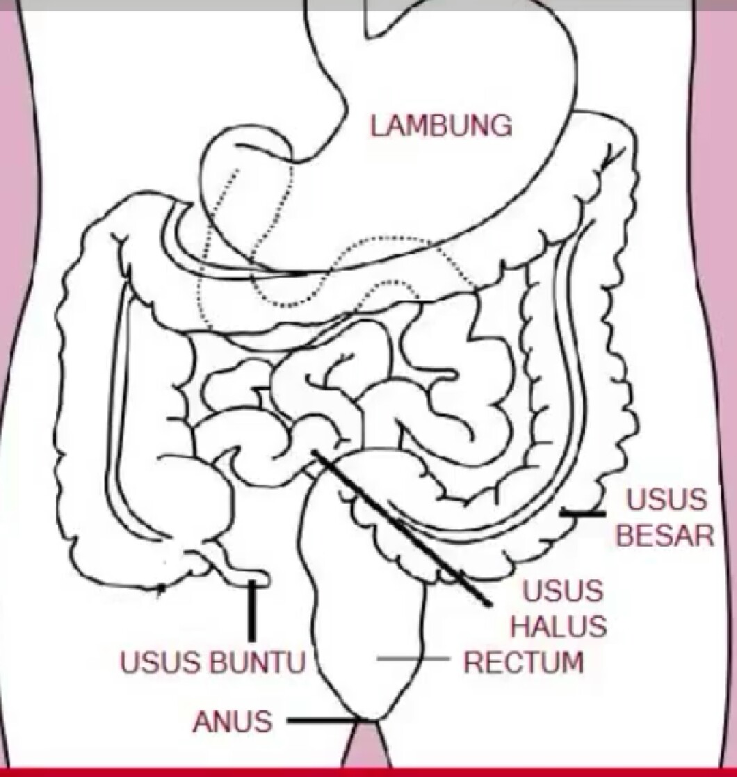 Gejala, Penyebab, dan Pengobatan Penyakit Usus Buntu
