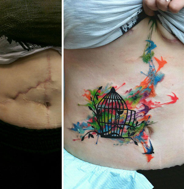 25 Beautiful Tattoos That Transformed Scars Into Artworks