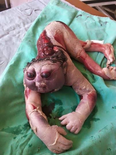 Images Of Woman Giving Birth 89