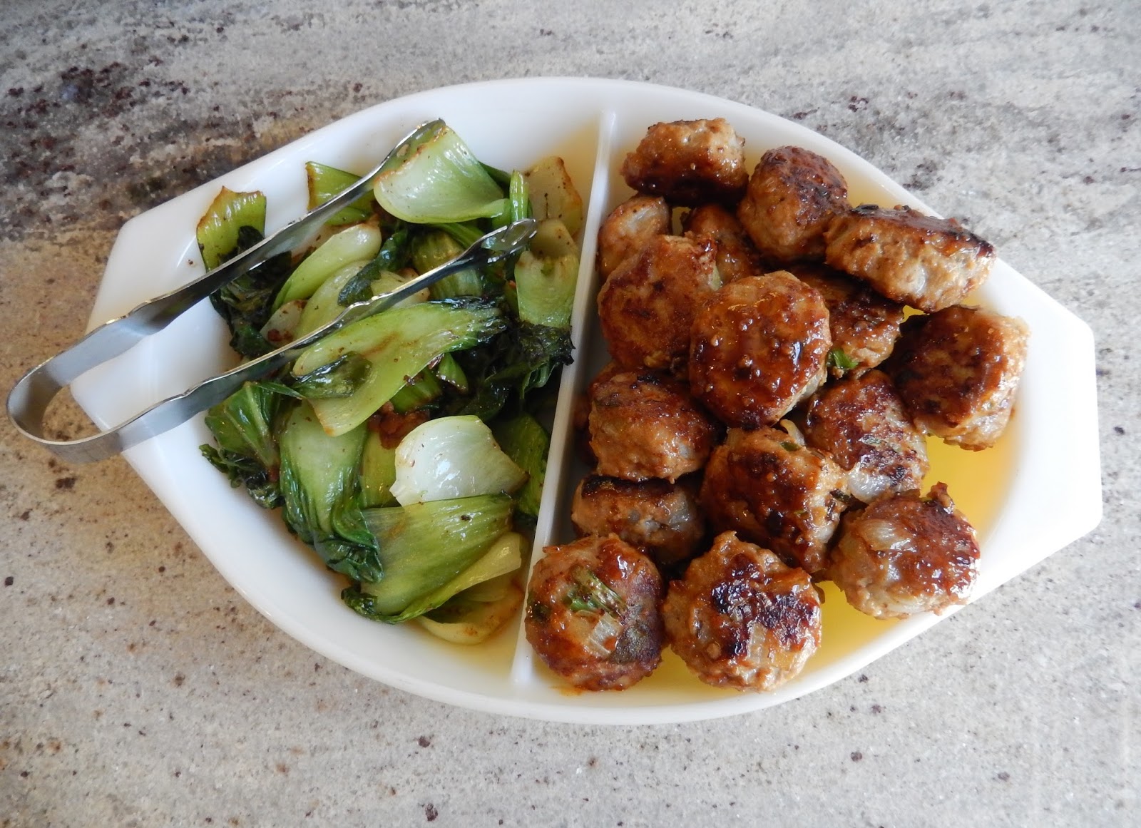 theworldaccordingtoeggface Post Weight Loss Surgery Menus A day in my