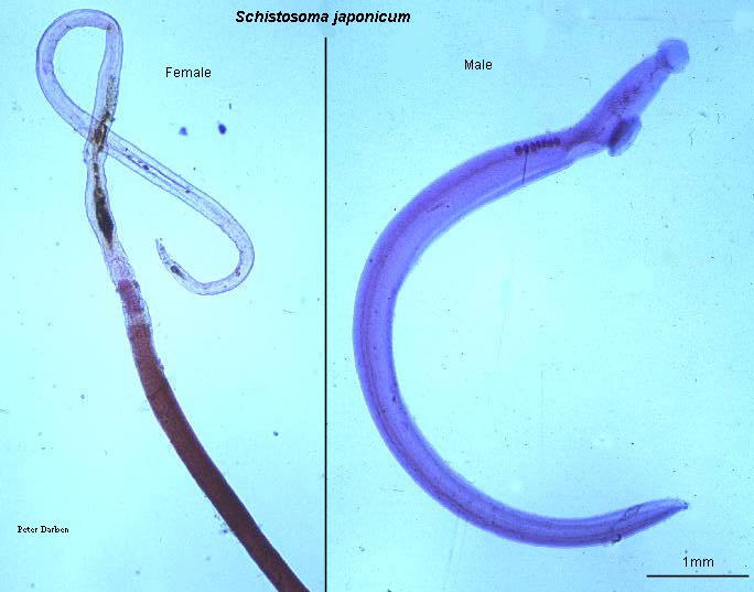 gambar penyakit schistosomiasis