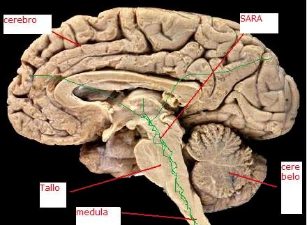 sistema reticular, tallo cerebral, homúsculo de Prenfield, Afasias y ...