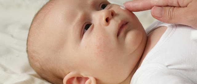 skin rashes on babies legs