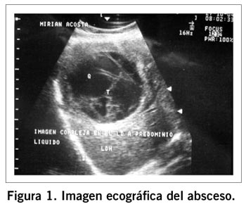 Locura medica: Absceso hepático amebiano