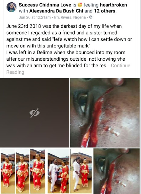  "I regret loving you like my sister" - Nigerian lady cries out after her best friend slashed her face with razor blade