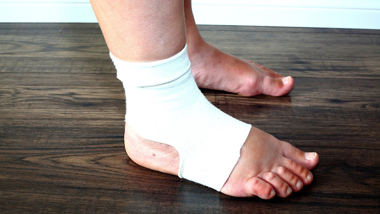 Causes Of Ankle Swelling Without Injury Injury Choices